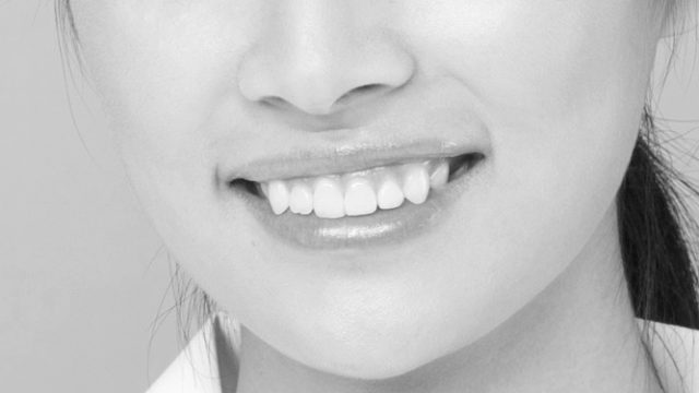 女性の歯 口 ほうれい線