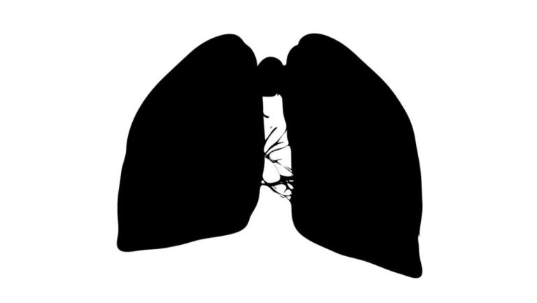 胸部 肺